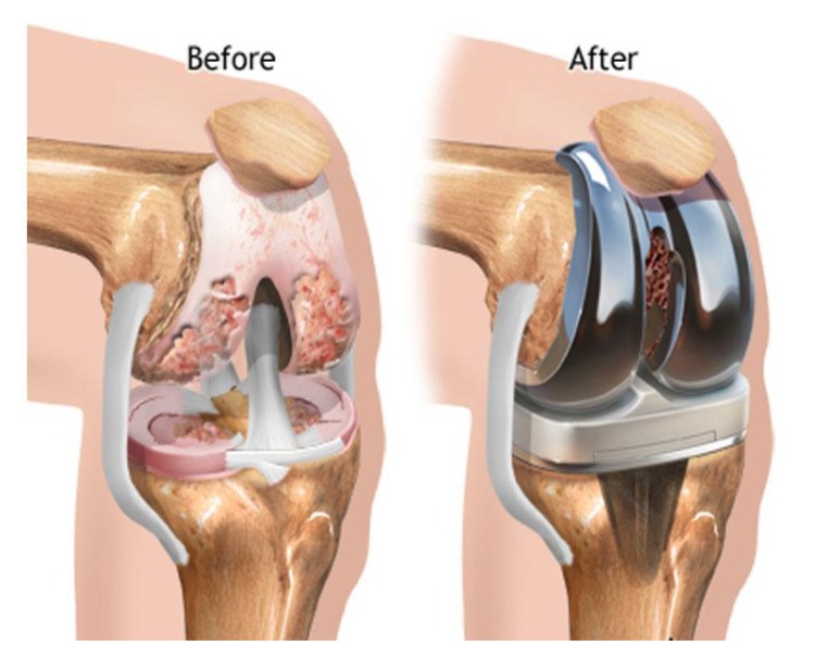 Orthopaedics